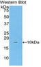Lecithin-Cholesterol Acyltransferase antibody, LS-C295100, Lifespan Biosciences, Western Blot image 