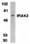 Interleukin 1 Receptor Associated Kinase 2 antibody, 2213, QED Bioscience, Western Blot image 