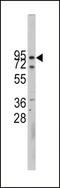 Cadherin 10 antibody, 58-022, ProSci, Western Blot image 