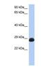 Ras-related protein Rab-39B antibody, NBP1-58900, Novus Biologicals, Western Blot image 