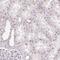 Regulation Of Nuclear Pre-MRNA Domain Containing 1B antibody, NBP2-55788, Novus Biologicals, Immunohistochemistry paraffin image 