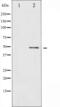 BLNK antibody, abx010470, Abbexa, Western Blot image 