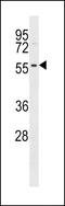 Serine/Threonine Kinase 17a antibody, LS-C100747, Lifespan Biosciences, Western Blot image 