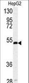 Serpin Family H Member 1 antibody, LS-C100549, Lifespan Biosciences, Western Blot image 