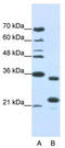 AlkB Homolog 8, TRNA Methyltransferase antibody, TA343983, Origene, Western Blot image 