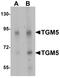 Transglutaminase 5 antibody, PA5-72718, Invitrogen Antibodies, Western Blot image 
