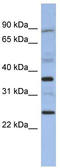 MAGE Family Member B3 antibody, TA337657, Origene, Western Blot image 