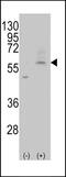 Solute Carrier Family 29 Member 4 antibody, GTX82546, GeneTex, Western Blot image 