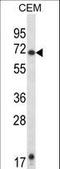 Histamine Receptor H1 antibody, LS-C165015, Lifespan Biosciences, Western Blot image 