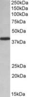 Poly(rC)-binding protein 1 antibody, NBP1-52114, Novus Biologicals, Western Blot image 