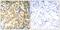 Nuclear Factor Kappa B Subunit 2 antibody, GTX50610, GeneTex, Immunohistochemistry paraffin image 