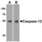 Caspase-12 antibody, 2327, QED Bioscience, Western Blot image 