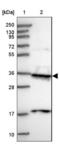 Protein Phosphatase 4 Catalytic Subunit antibody, NBP2-13802, Novus Biologicals, Western Blot image 