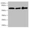 Keratin 6A antibody, CSB-PA012561LA01HU, Cusabio, Western Blot image 