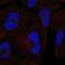 Clathrin Heavy Chain Like 1 antibody, NBP2-56534, Novus Biologicals, Immunocytochemistry image 