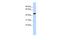 Prostaglandin I2 Synthase antibody, PA5-42564, Invitrogen Antibodies, Western Blot image 