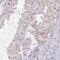 Zinc finger protein DZIP1 antibody, NBP2-31669, Novus Biologicals, Immunohistochemistry paraffin image 