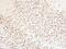 Methyl-CpG Binding Protein 2 antibody, A00047, Boster Biological Technology, Immunohistochemistry paraffin image 