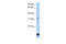 Beta-1,3-Galactosyltransferase 6 antibody, 26-502, ProSci, Western Blot image 