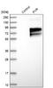 PVR Cell Adhesion Molecule antibody, NBP1-88131, Novus Biologicals, Western Blot image 