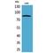 Platelet Derived Growth Factor Receptor Alpha antibody, LS-C387053, Lifespan Biosciences, Western Blot image 