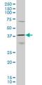 Homeobox D11 antibody, H00003237-M10, Novus Biologicals, Western Blot image 