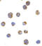 Ire1-alpha antibody, 3657, ProSci Inc, Immunocytochemistry image 