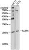 Fatty Acid Binding Protein 6 antibody, 22-544, ProSci, Western Blot image 