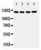 Zinc Finger E-Box Binding Homeobox 1 antibody, PA1986, Boster Biological Technology, Western Blot image 