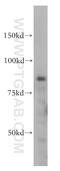 Inhibitor Of Nuclear Factor Kappa B Kinase Subunit Beta antibody, 15649-1-AP, Proteintech Group, Western Blot image 