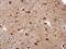 Musashi RNA Binding Protein 2 antibody, PA5-31024, Invitrogen Antibodies, Immunohistochemistry frozen image 