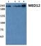 Mediator Complex Subunit 12 antibody, PA5-75852, Invitrogen Antibodies, Western Blot image 