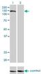 Trafficking Protein Particle Complex 10 antibody, H00007109-M01, Novus Biologicals, Western Blot image 