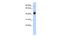 RBMX Like 2 antibody, PA5-41848, Invitrogen Antibodies, Western Blot image 