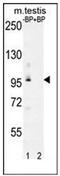 Pyruvate Dehydrogenase Phosphatase Regulatory Subunit antibody, AP53247PU-N, Origene, Western Blot image 