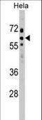 Suppressor Of Cytokine Signaling 7 antibody, LS-C161384, Lifespan Biosciences, Western Blot image 