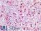 Elastase, Neutrophil Expressed antibody, LS-B16906, Lifespan Biosciences, Immunohistochemistry paraffin image 