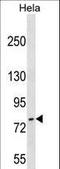 FAST Kinase Domains 3 antibody, LS-C159625, Lifespan Biosciences, Western Blot image 