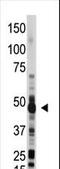 2'-5'-Oligoadenylate Synthetase 1 antibody, LS-C100473, Lifespan Biosciences, Western Blot image 