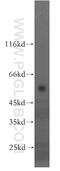 Transmembrane Protein 175 antibody, 19925-1-AP, Proteintech Group, Western Blot image 