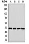 Farnesyltransferase, CAAX Box, Beta antibody, LS-C353984, Lifespan Biosciences, Western Blot image 