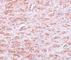 Caudal Type Homeobox 2 antibody, NBP1-77113, Novus Biologicals, Immunohistochemistry frozen image 