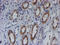 Spermatogenesis And Centriole Associated 1 Like antibody, M15055, Boster Biological Technology, Immunohistochemistry paraffin image 