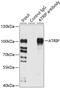 ATR Interacting Protein antibody, 22-734, ProSci, Immunoprecipitation image 