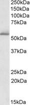 Phosphodiesterase 1A antibody, EB09802, Everest Biotech, Western Blot image 