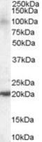 ADP Ribosylation Factor Like GTPase 6 Interacting Protein 5 antibody, MBS420007, MyBioSource, Western Blot image 