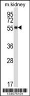 Somatostatin Receptor 1 antibody, 57-432, ProSci, Western Blot image 