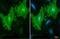 Actin Alpha 2, Smooth Muscle antibody, GTX100034, GeneTex, Immunocytochemistry image 