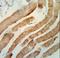 RAB7A, Member RAS Oncogene Family antibody, LS-C162393, Lifespan Biosciences, Immunohistochemistry paraffin image 