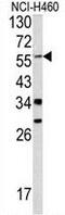 Yes Associated Protein 1 antibody, GTX81839, GeneTex, Western Blot image 